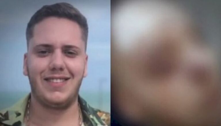 Jovem tem rosto desfigurado a golpes de facão em Santana dos Garrotes