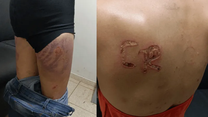 Polícia prende homem que agredia mulher e marcou as iniciais do nome dele nas costas da vítima