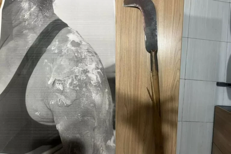 Homem é preso após jogar feijão quente na companheira